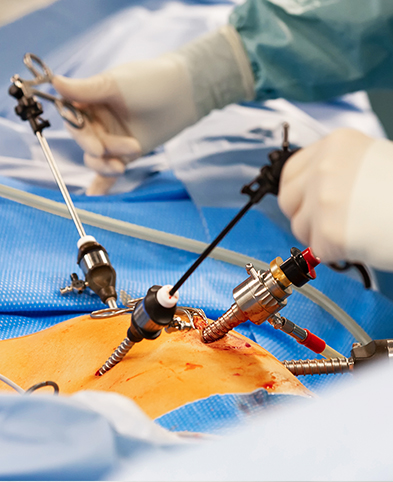 Detail-Darstellung einer Operation – Chirurg und OP-Team führen einen minimal-invasiven Eingriff durch.